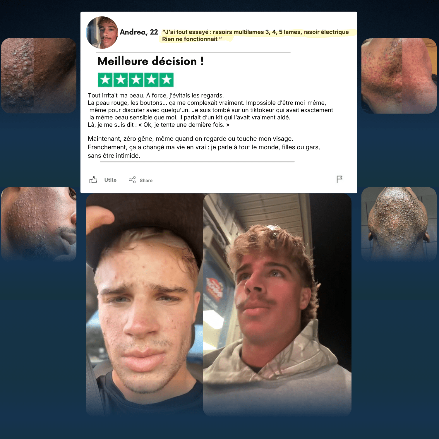 KIT RASAGE & EXFOLIANT BARBE NOIRE ® pour homme – rasage de précision sans irritation | Barbenoire