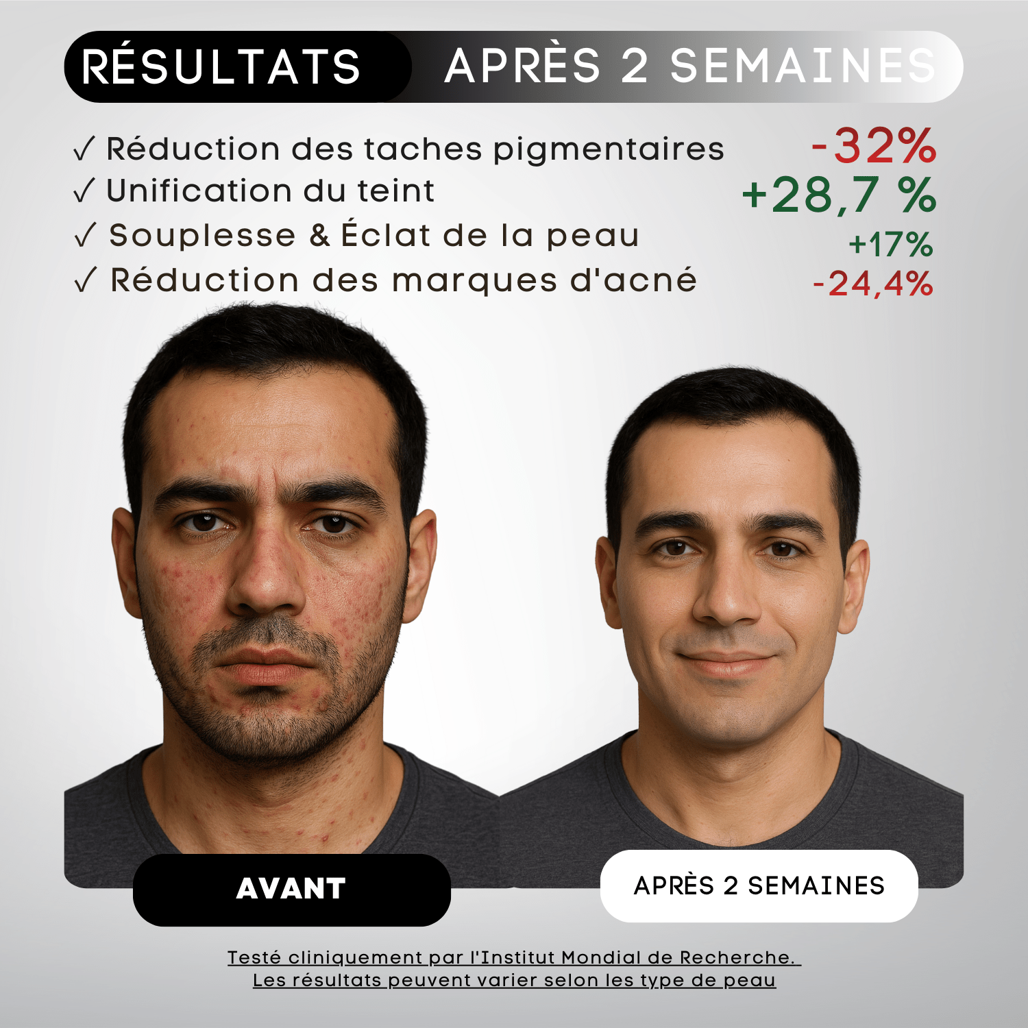 KIT DE RASAGE ANTI - IRRITATIONS COMPLET– ZÉRO FEU DU RASOIR & POILS INCARNÉS pour homme – rasage de précision sans irritation | Barbenoire