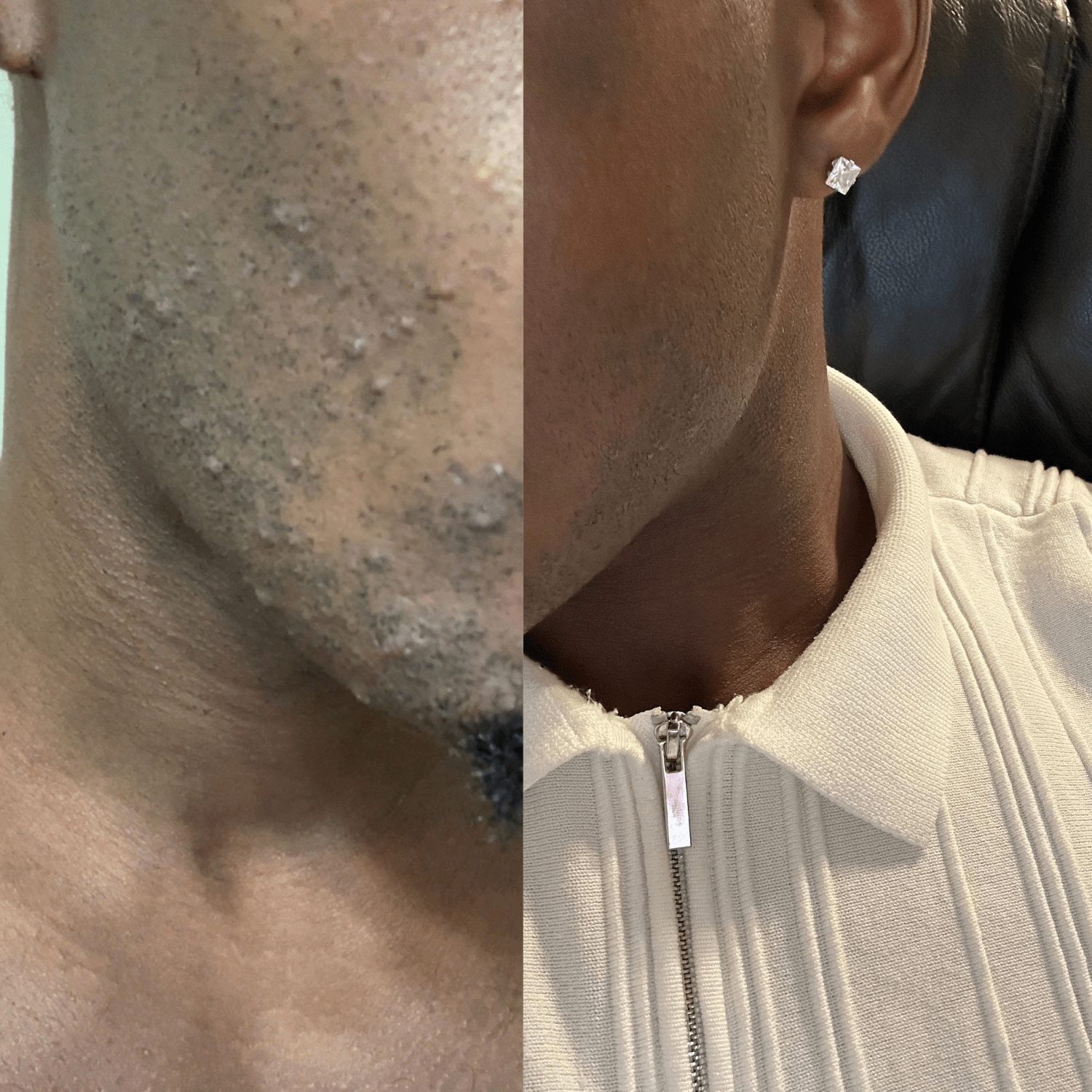 BROSSE EXFOLIANTE PRÉ - RASAGE – POUR UNE PEAU LISSE & SANS BOUTONS pour homme – rasage de précision sans irritation | Barbenoire