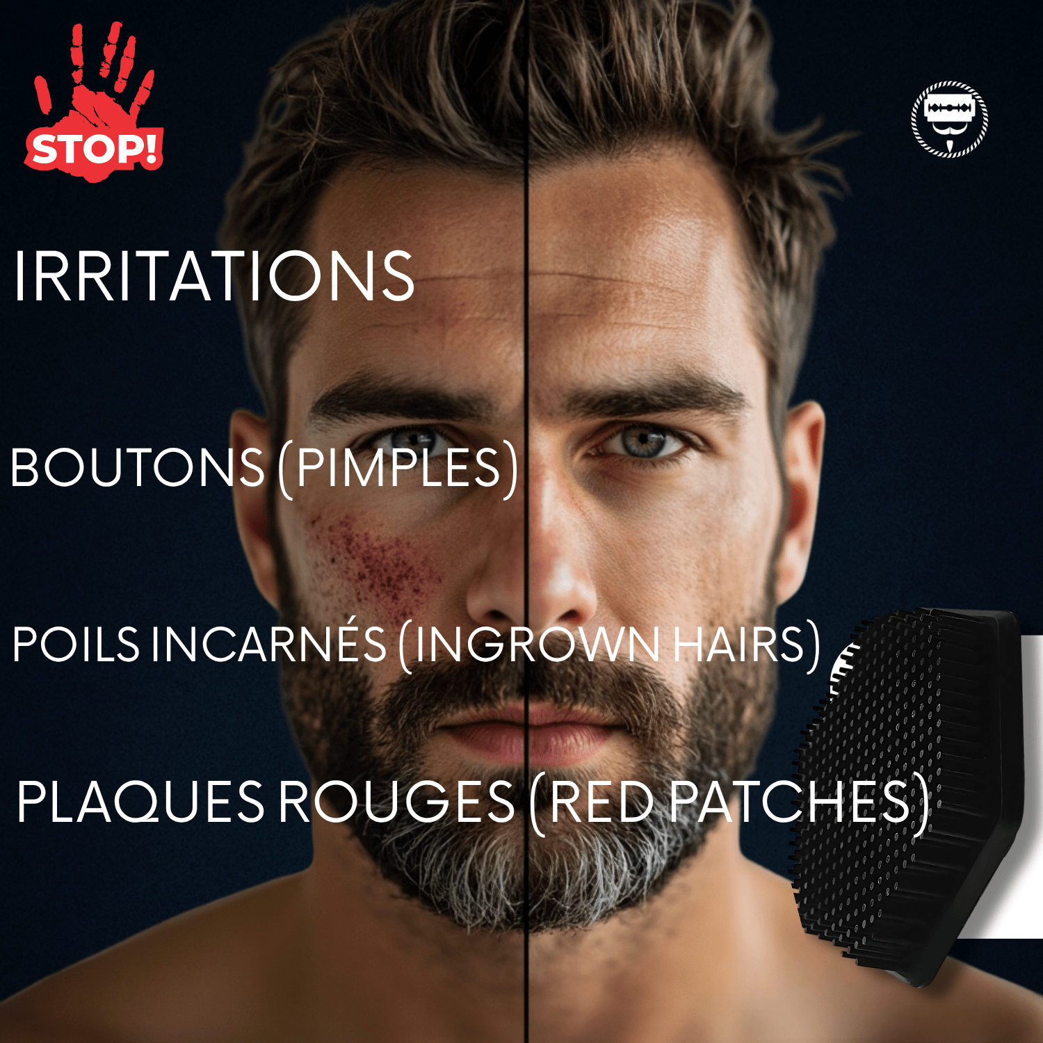BROSSE EXFOLIANTE PRO BARBE NOIRE® pour homme – rasage de précision sans irritation | Barbenoire