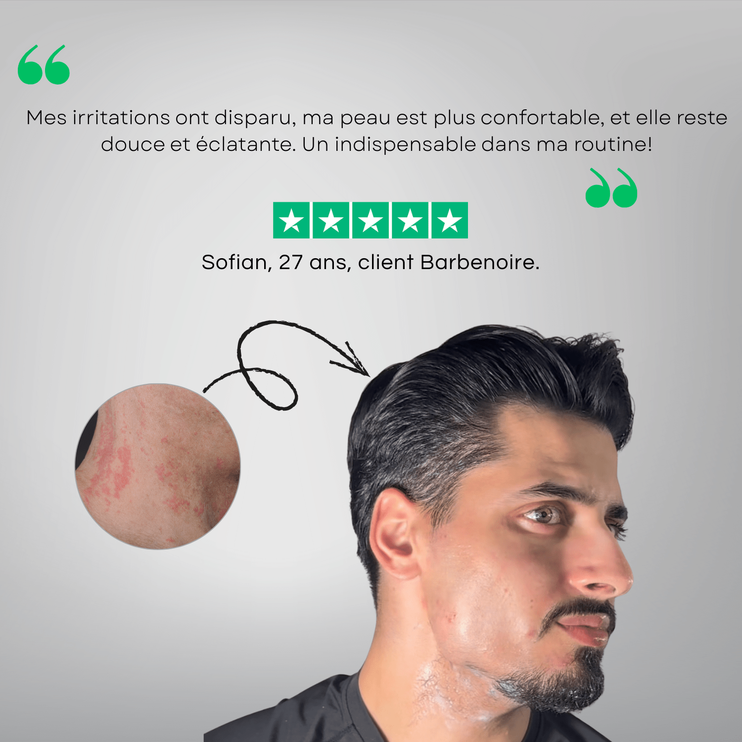 KIT DE RASAGE ANTI - IRRITATIONS COMPLET– ZÉRO FEU DU RASOIR & POILS INCARNÉS pour homme – rasage de précision sans irritation | Barbenoire