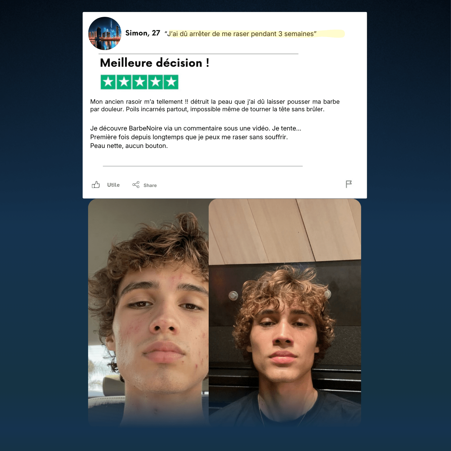 KIT RASAGE & EXFOLIANT BARBE NOIRE ® pour homme – rasage de précision sans irritation | Barbenoire